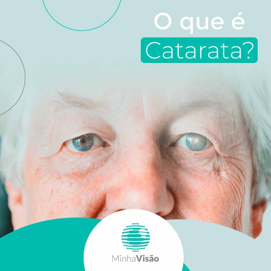 o que é catarata