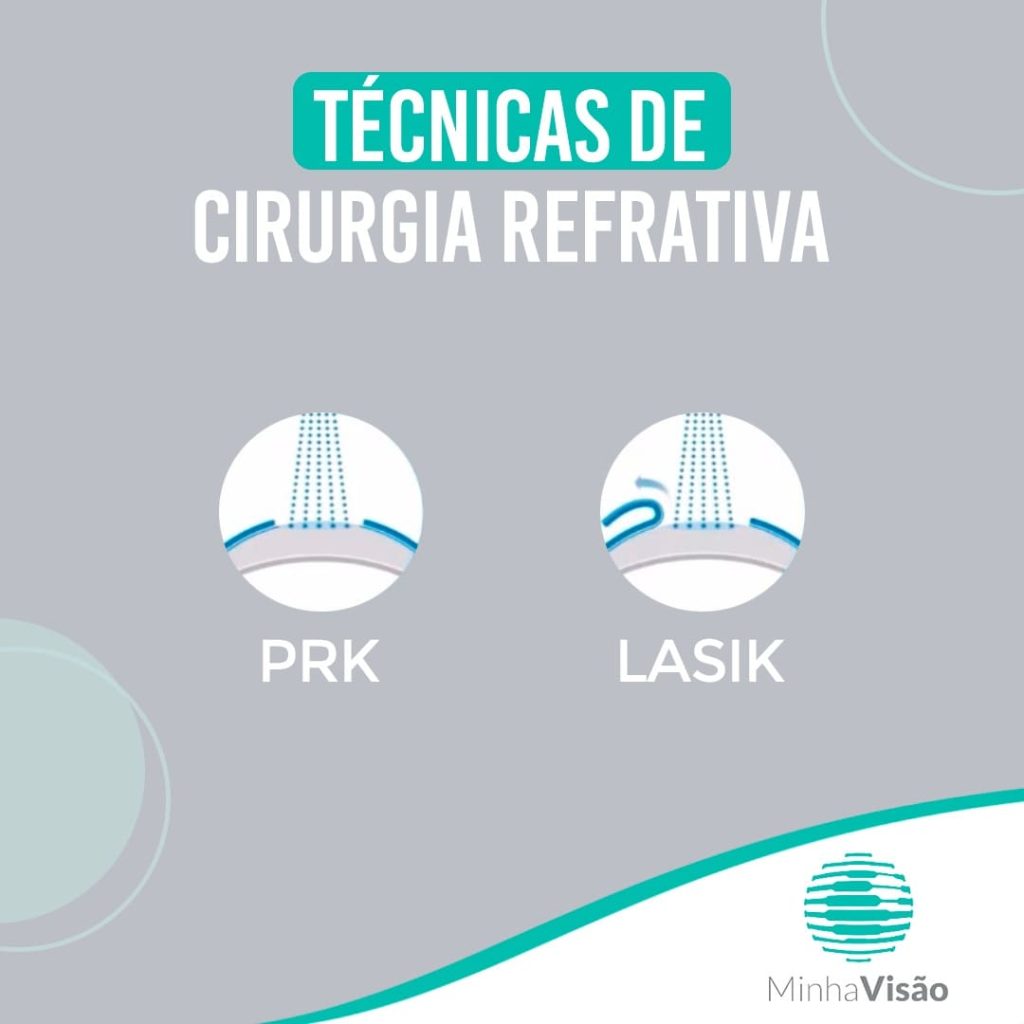 Técnicas de cirurgia refrativa