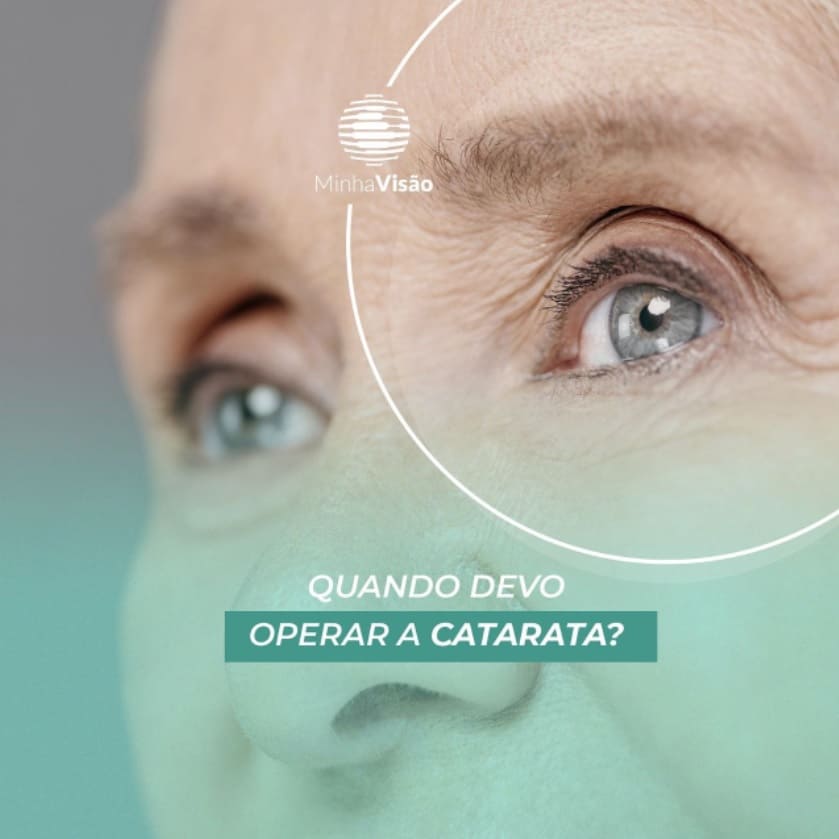 Quando devo operar a catarata