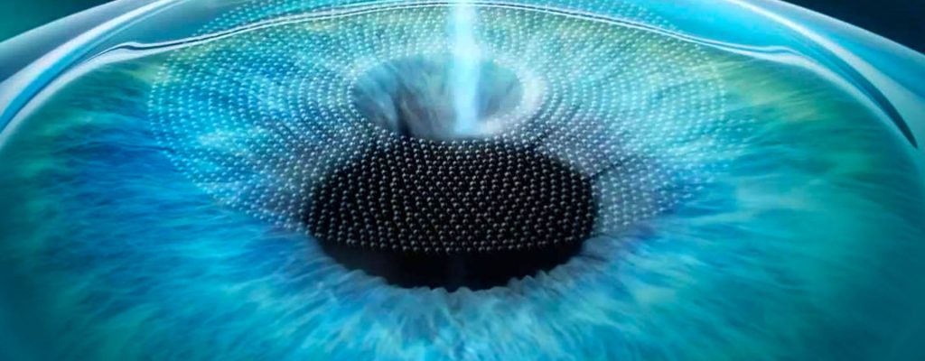 Ja-ouviu-falar-em-Femto-Lasik